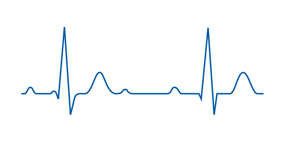 Noninvasive monitoring of central hemodynamic parameters