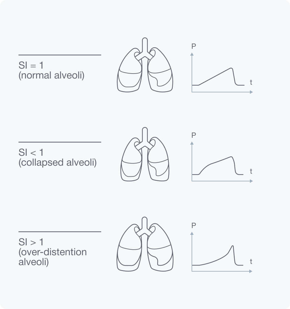 Extended Respiratory Monitoring