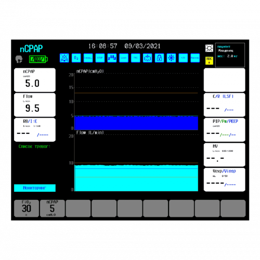 Intensive Care Ventilator Zisline MV350 Version K0